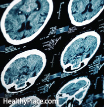 A lesão cerebral traumática (TCE) é comum em soldados destacados, mas pode aumentar o risco de uma pessoa de transtorno de estresse pós-traumático relacionado ao combate (PTSD).