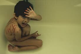 Marcas de laceração de abuso físico infantil