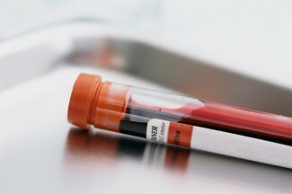 Recentemente, foi anunciado um exame de sangue para prever o aumento do risco de suicídio, mas podemos realmente prever o risco de suicídio com um simples exame de sangue?